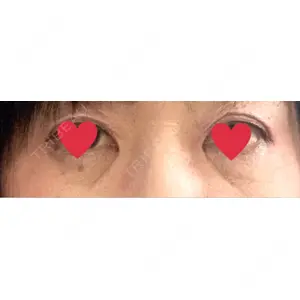東京美容外科 東京美容外科 梅田院口コミ