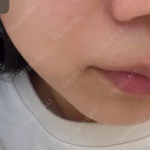 ハナビューティークリニック口コミ