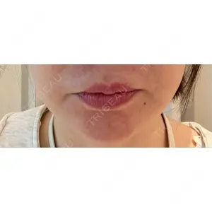 APスキンクリニック銀座口コミ