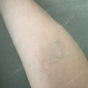 グリシーヌクリニック口コミ