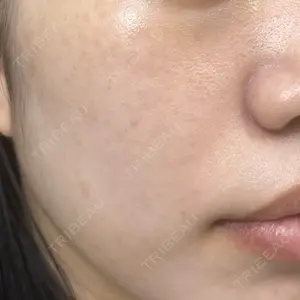 ルラ美容クリニック ルラ美容クリニック 新宿院口コミ