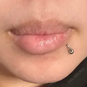 口コミ