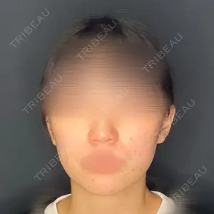 CZEN CLINIC 銀座院口コミ