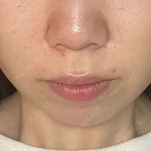 ライズワン美容皮膚科クリニック口コミ