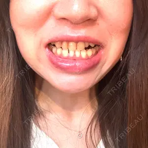 口コミ