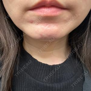 プロクリニック PRO CLINIC プロクリニック 銀座院口コミ