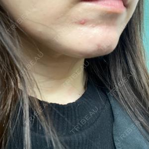 プロクリニック PRO CLINIC プロクリニック 銀座院口コミ