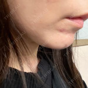 プロクリニック PRO CLINIC プロクリニック 銀座院口コミ