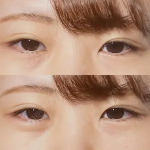 渋谷美容外科クリニック 渋谷美容外科クリニック 渋谷院口コミ