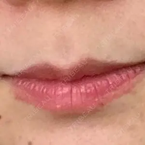 口コミ