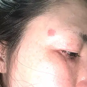 APスキンクリニック銀座口コミ