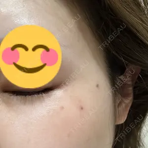 APスキンクリニック銀座口コミ