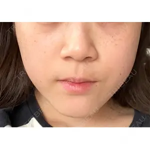 L‘amour clinic Tokyo【ラムールクリニック東京】口コミ