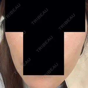 椿クリニック 銀座TSUBAKIクリニック口コミ
