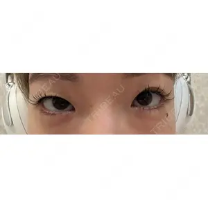 口コミ