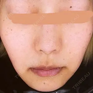 ハナビューティークリニック口コミ