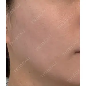 ハナビューティークリニック口コミ