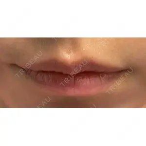 口コミ