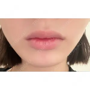PRO CLINIC プロクリニック 銀座院口コミ