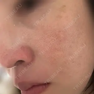 ルラ美容クリニック ルラ美容クリニック 新宿院口コミ