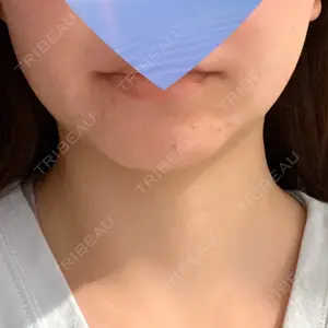 口コミ