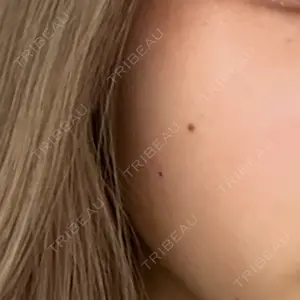 プライベートスキンクリニック 梅田本院口コミ