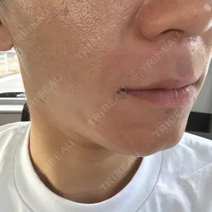フィラークリニック フィラークリニック 名古屋栄院口コミ