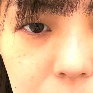 A CLINIC（エークリニック） A CLINIC（エークリニック） 福岡院口コミ