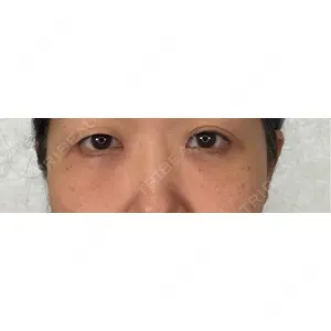 口コミ