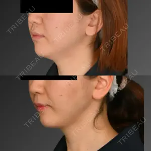 Lipo Clinic omotesando口コミ