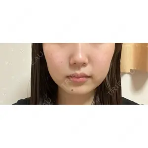 口コミ