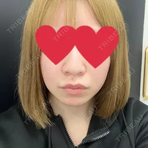 口コミ