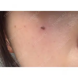 ハナビューティークリニック口コミ