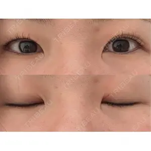口コミ