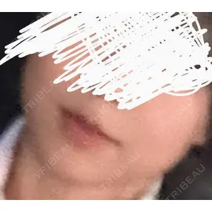 AYANAフィラーズクリニック AYANAフィラーズクリニック 渋谷院口コミ