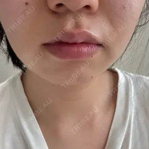HINATA クリニック口コミ