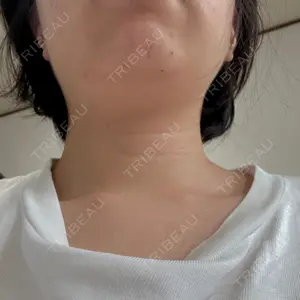 HINATA クリニック口コミ