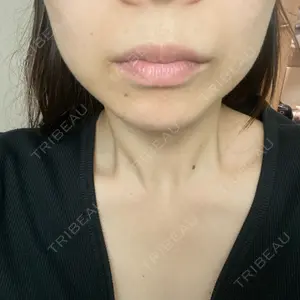 TCB東京中央美容外科 TCB東京中央美容外科 大宮東口院口コミ