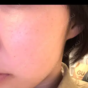 ルラ美容クリニック ルラ美容クリニック 札幌本院口コミ