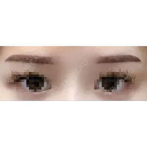 ヒロクリニック 三鷹ヒロクリニック 北口院 （医療脱毛）口コミ