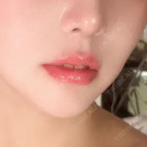 R Beauty CLINIC R Beauty CLINIC 銀座院口コミ