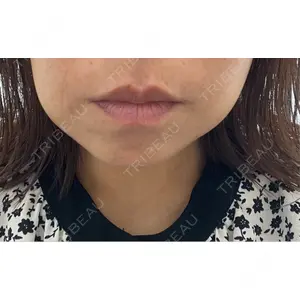 口コミ
