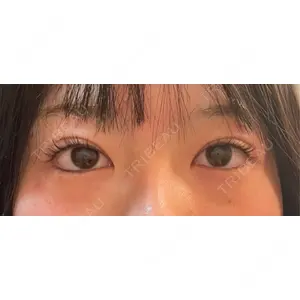 口コミ