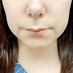 口コミ