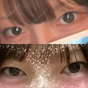 TCB東京中央美容外科 TCB東京中央美容外科 岐阜院口コミ