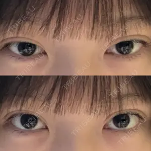 TCB東京中央美容外科 TCB東京中央美容外科 岐阜院口コミ