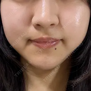 口コミ