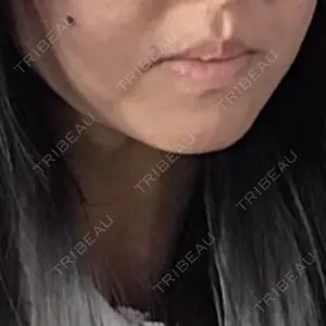 口コミ