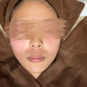 L‘amour clinic Tokyo【ラムールクリニック東京】口コミ