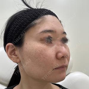 CZEN CLINIC 銀座院口コミ